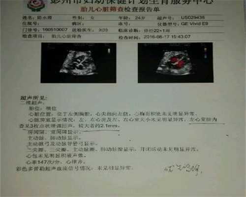 渭南市中心医院孕期体操开课啦