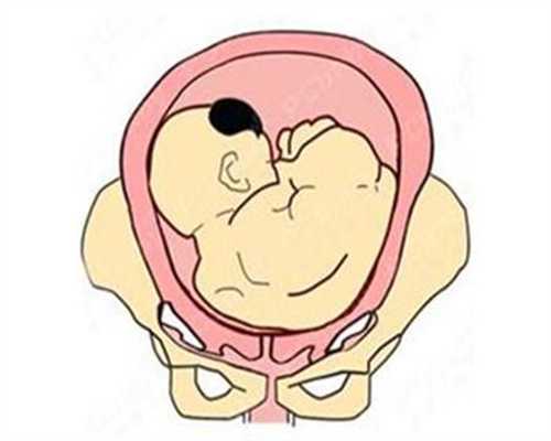 代孕后小肚子痉挛是怎么回事呢景年知几时