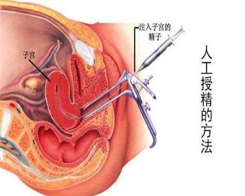 高效的代孕网-代孕代孕网-宫颈环扎后几周能下床