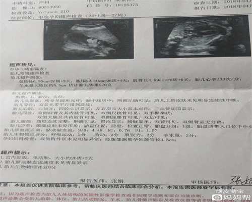 广州代孕网,做代孕的医院-月经期间可以进行性生