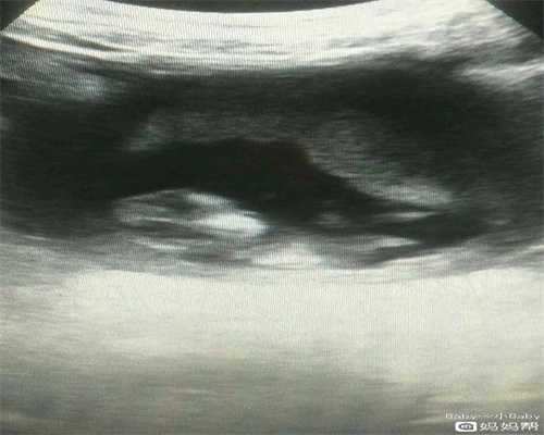 代孕女性最容易出现盆腔炎的阶段
