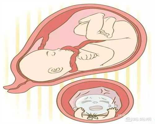 女性备北京代孕可以吃什么？