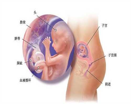 六种女性当心生出怪胎_广东助孕试管婴儿中心
