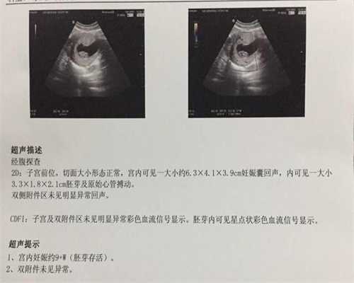 上海代孕谁做过_上海代孕费用为多少_上海圆梦代孕服务中心
